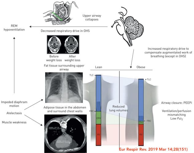 OHS Eur Resp Rev 18 Graph pathophys