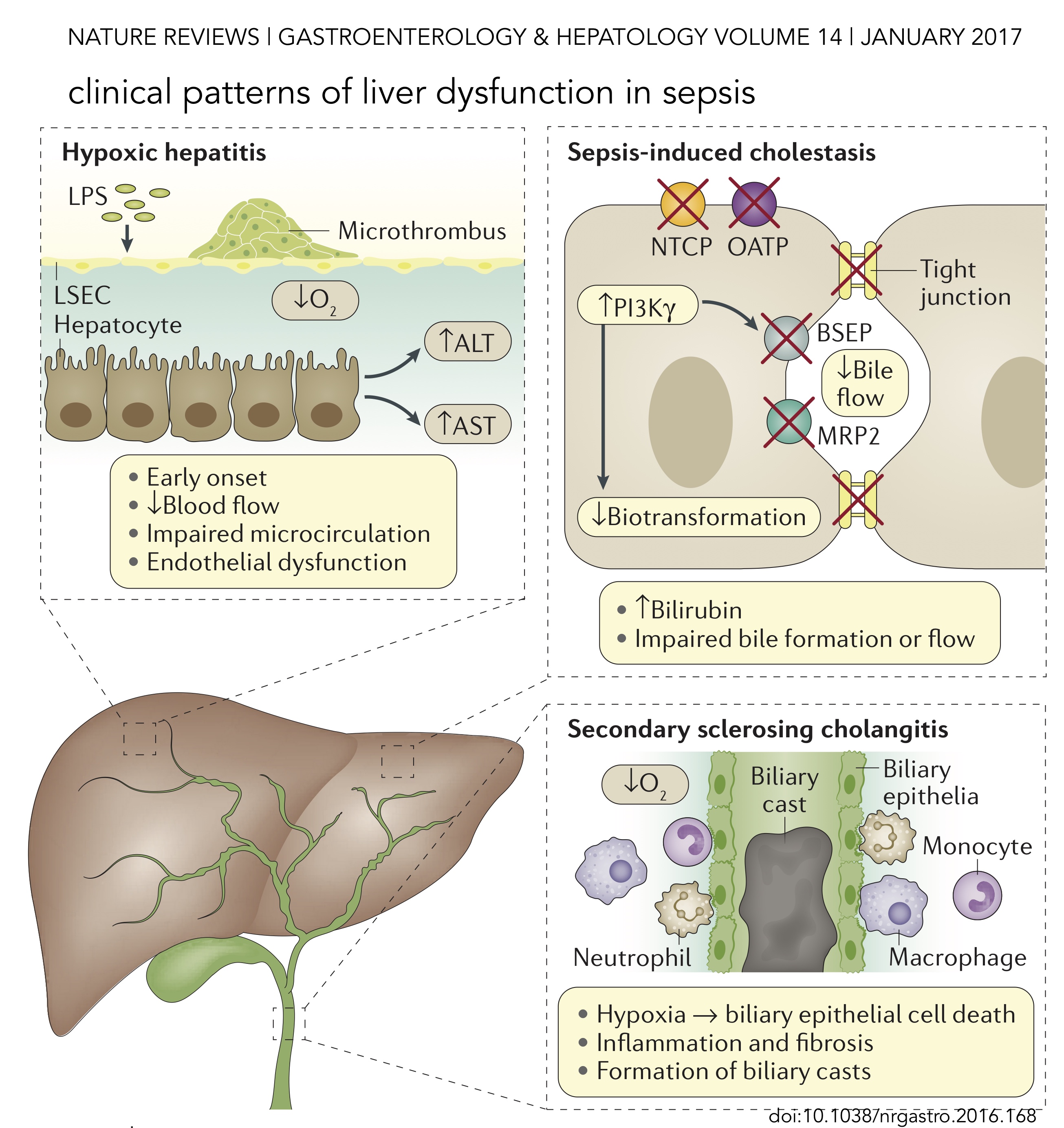 liver in sepsis and systemic infection | VIGILANTIA et HUMILITAS